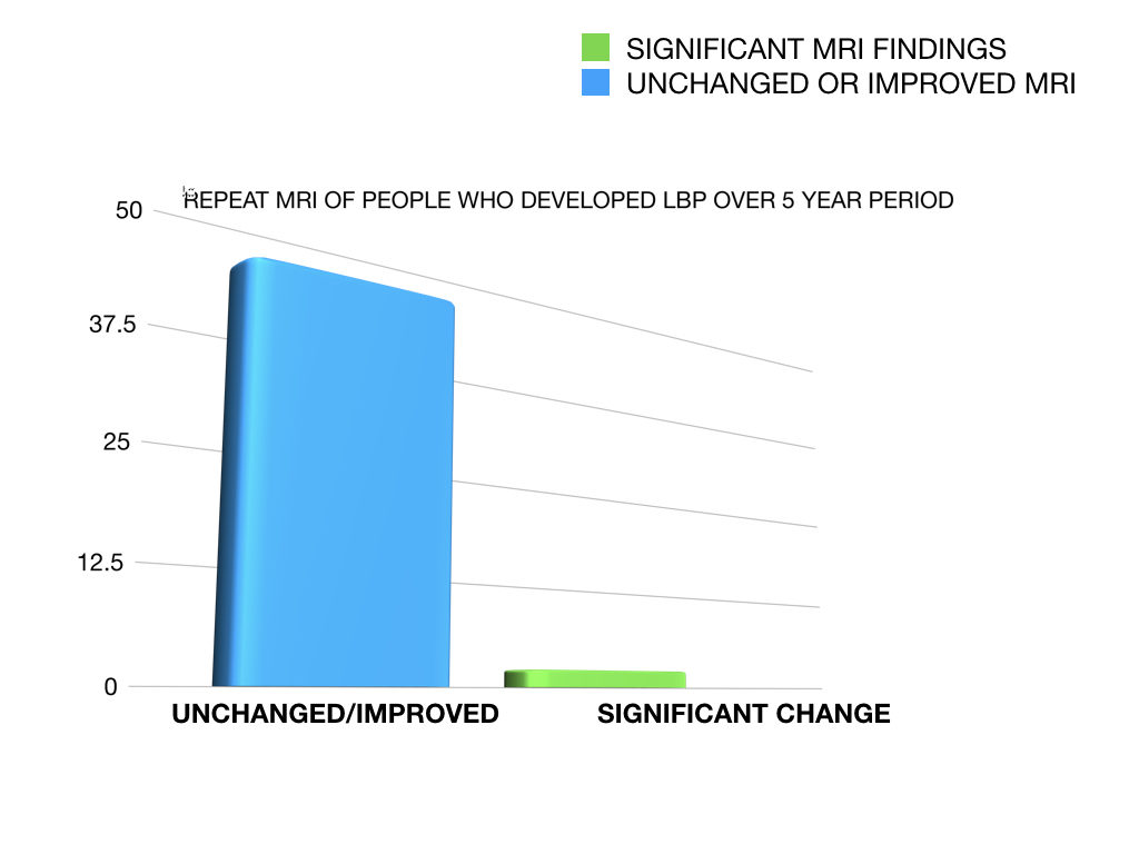 MRI findings before and after developing lower back pain