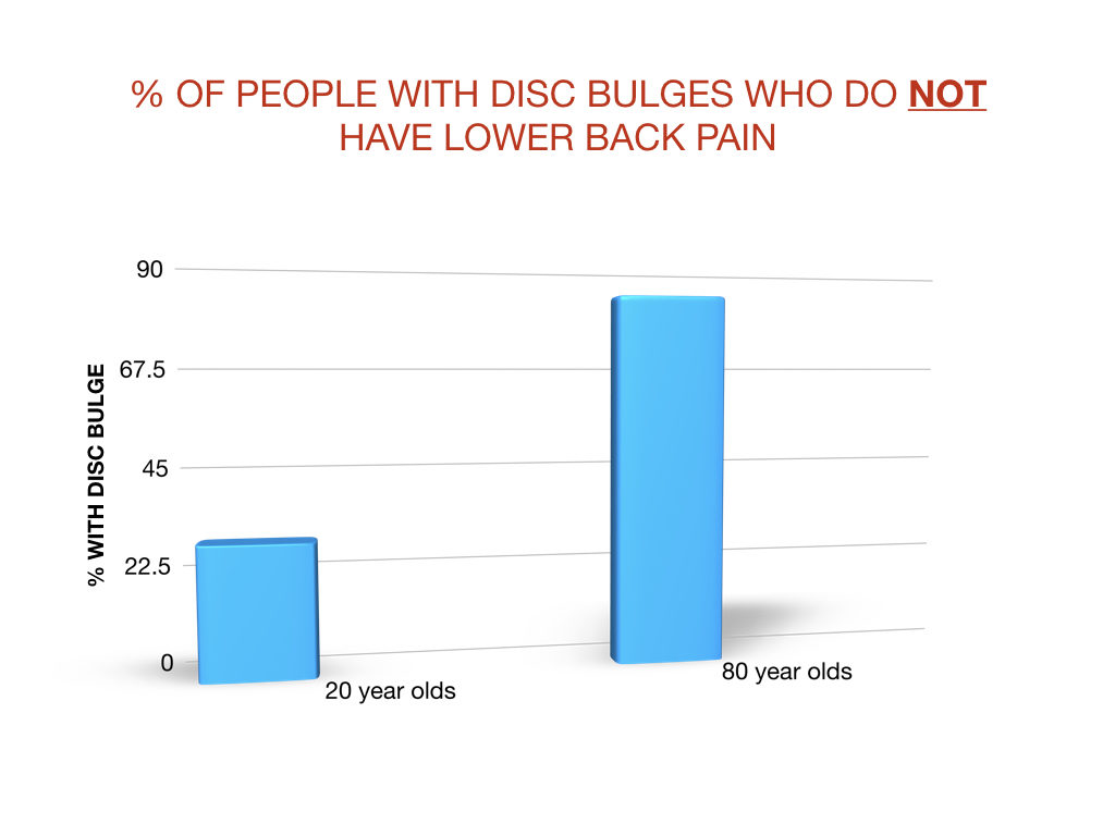 people without lower back pain with disc bulges on lumbar MRI