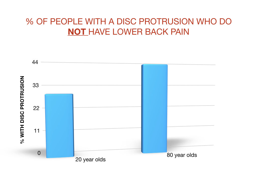 people without lower back pain with disc protrusion on MRI