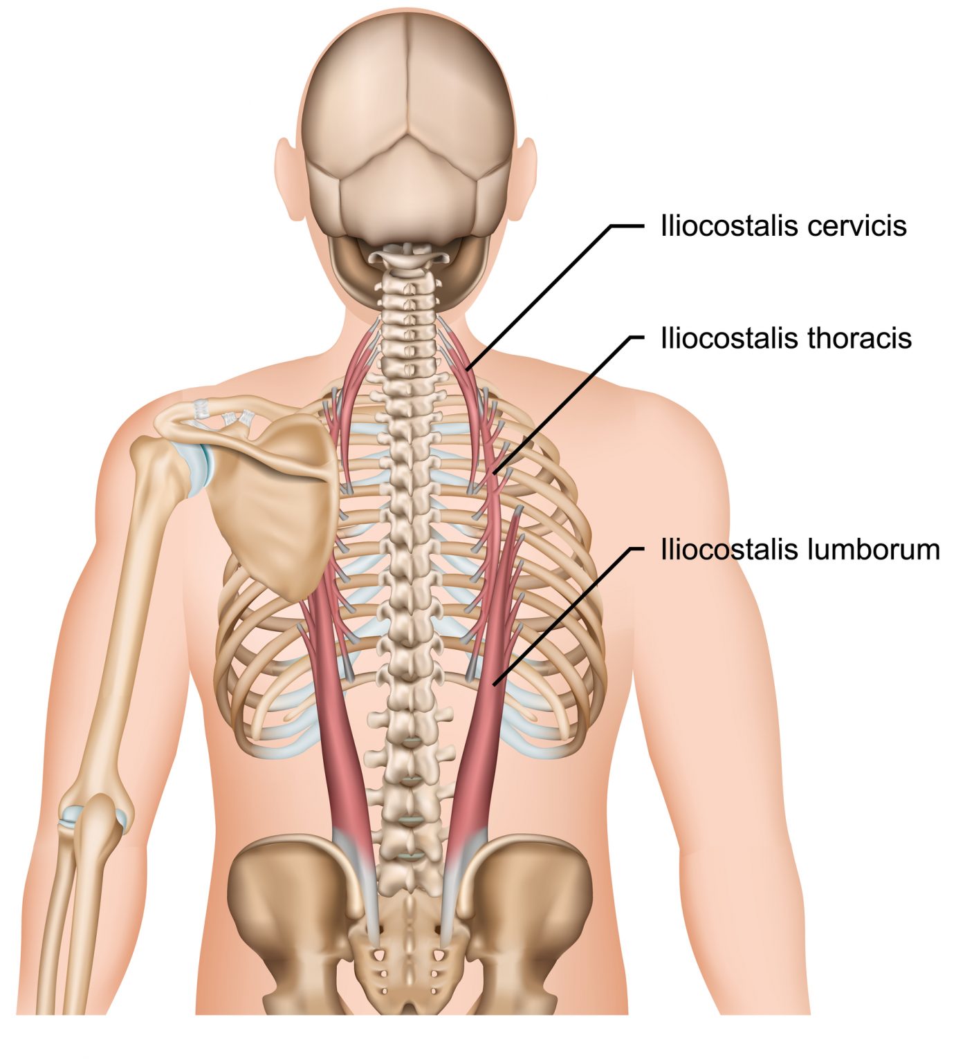 Paraspinal Muscles Crush Back Pain